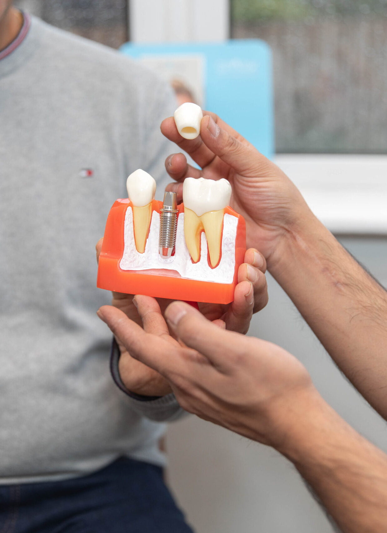 dental implants quick link image